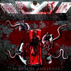 Sarcoidosis : Surgical Homicide